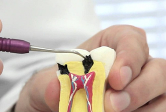  Endodontia - Especialidades - Salut Clínica Odontológica e Médica